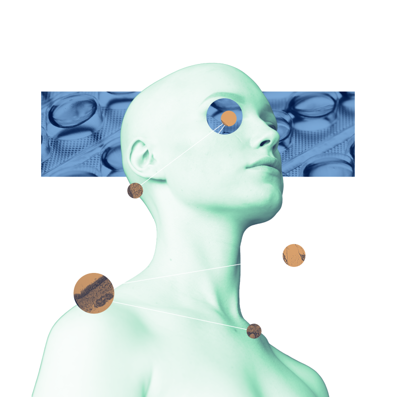 kv-xiieci